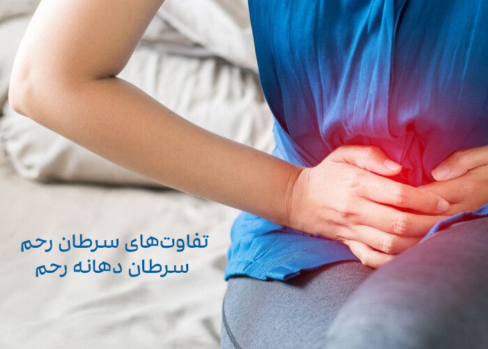 تفاوت‌های سرطان رحم و سرطان دهانه رحم